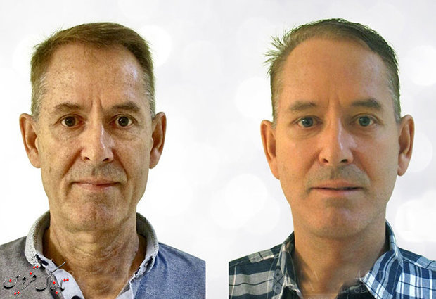 ۷ راه ساده اما موثر در پیشگیری از افتادگی پوست ۷ راه ساده اما موثر در پیشگیری از افتادگی پوست