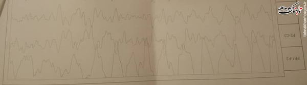 نوار مغزی شده گردنه&zwnj;گیری از فقرا
